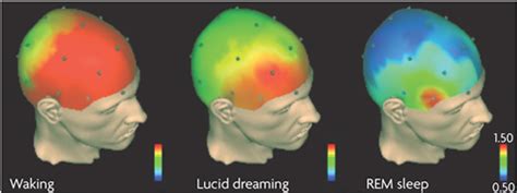 Brain Activity During Lucid Dreaming