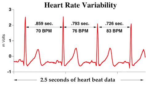 Heart Rate Variability